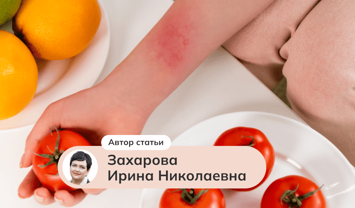 Лечение зуда при пищевой аллергии: мнение экспертов