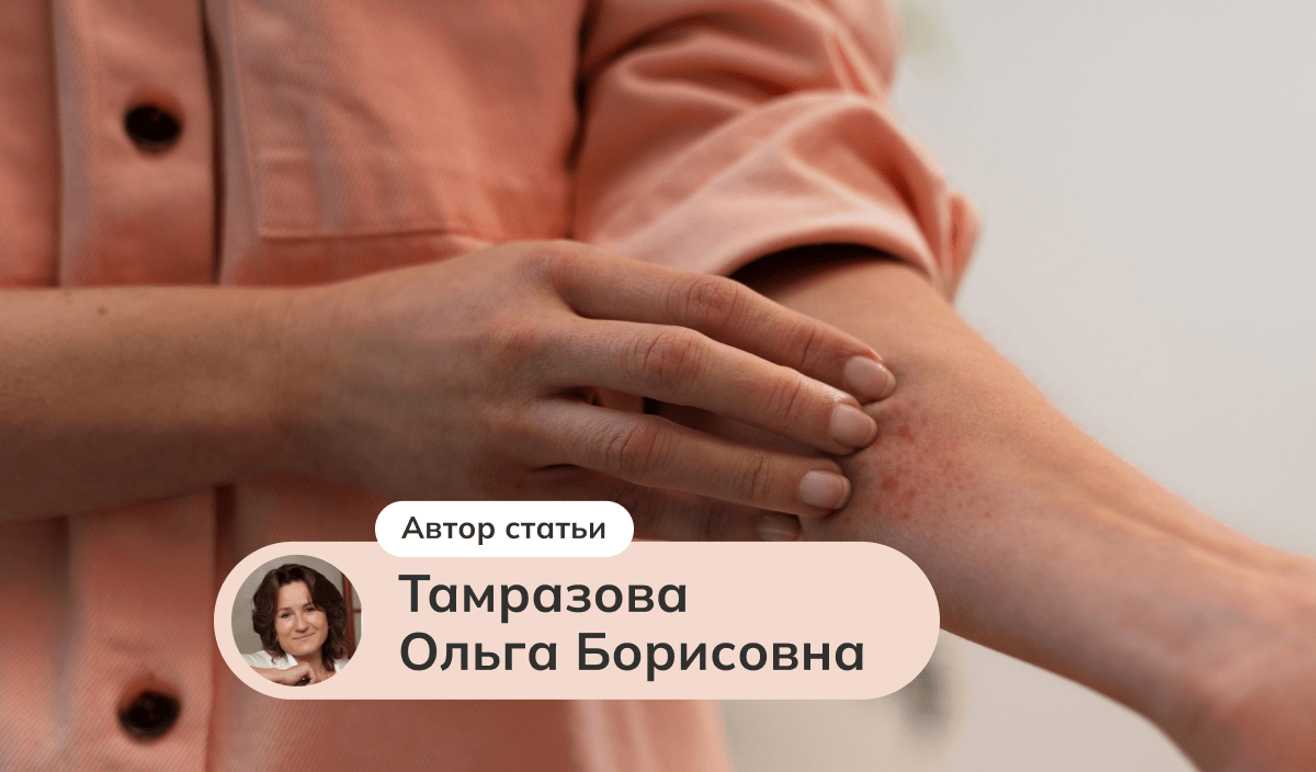 Клинические случаи: современная терапия зудящих дерматозов